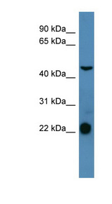SSTR1 Antibody - SSTR1 antibody Western blot of THP-1 cell lysate. This image was taken for the unconjugated form of this product. Other forms have not been tested.