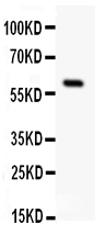 SSTR1 Antibody - Western blot - Anti-Somatostatin Receptor 1 Antibody