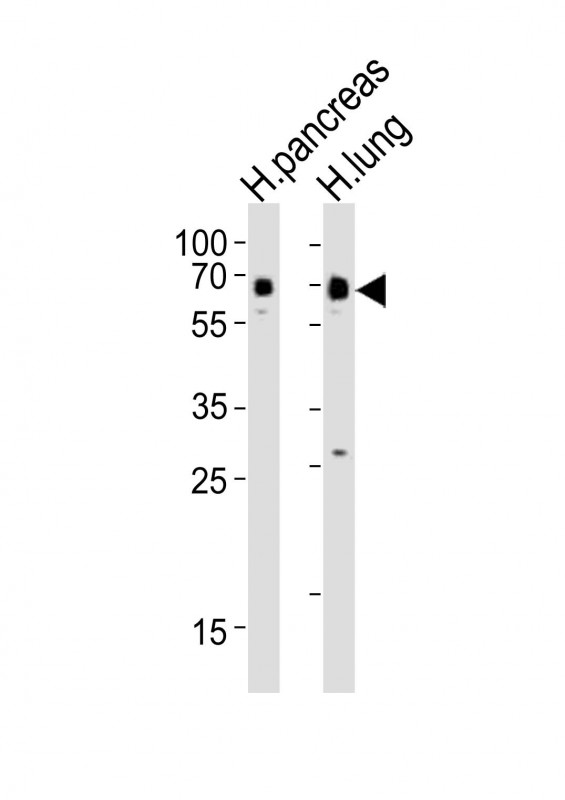 SSTR1 Antibody - All lanes : Anti-SSTR1 Antibody at 1:4000 dilution Lane 1: human pancreas lysates Lane 2: human lung lysates Lysates/proteins at 20 ug per lane. Secondary Goat Anti-Rabbit IgG, (H+L), Peroxidase conjugated at 1/10000 dilution Predicted band size : 43 kDa Blocking/Dilution buffer: 5% NFDM/TBST.