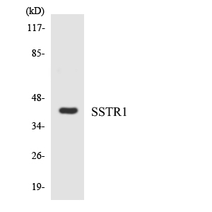 SSTR1 Antibody - Western blot analysis of the lysates from COLO205 cells using SSTR1 antibody.
