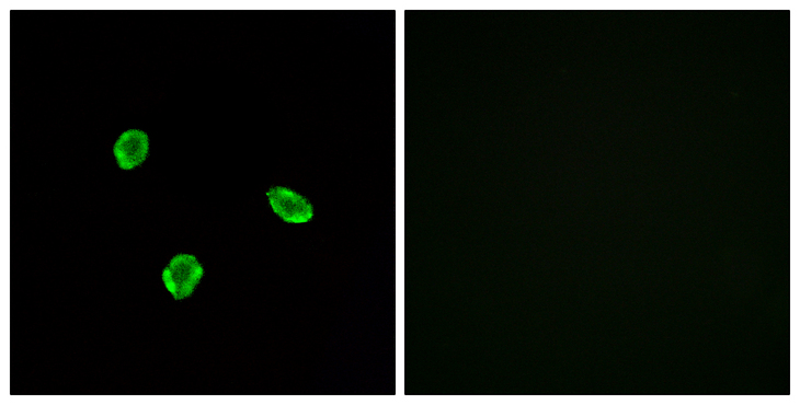 SSTR1 Antibody - Immunofluorescence analysis of A549 cells, using SSTR1 Antibody. The picture on the right is blocked with the synthesized peptide.