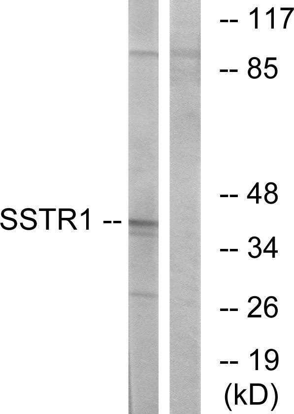 SSTR1 Antibody - Western blot analysis of lysates from COS7 cells, using SSTR1 Antibody. The lane on the right is blocked with the synthesized peptide.