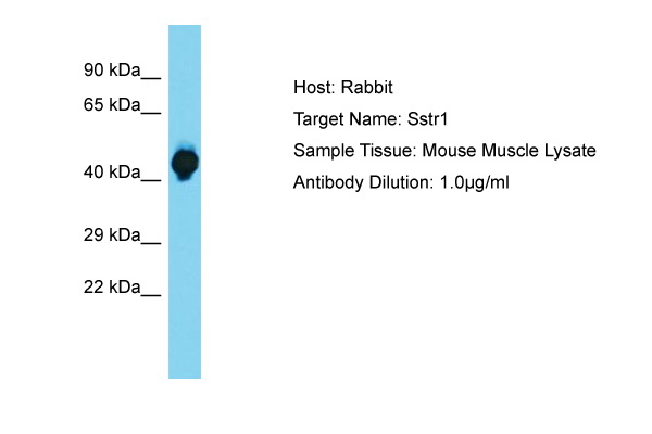 SSTR1 Antibody -  This image was taken for the unconjugated form of this product. Other forms have not been tested.