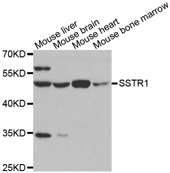 SSTR1 Antibody - Western blot analysis of extracts of various tissues.