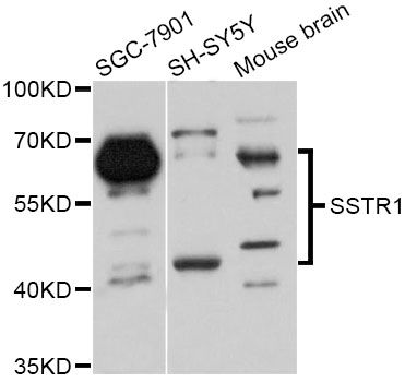 SSTR1 Antibody - Western blot analysis of extracts of various cell lines, using SSTR1 Antibody at 1:3000 dilution. The secondary antibody used was an HRP Goat Anti-Rabbit IgG (H+L) at 1:10000 dilution. Lysates were loaded 25ug per lane and 3% nonfat dry milk in TBST was used for blocking. An ECL Kit was used for detection and the exposure time was 90s.
