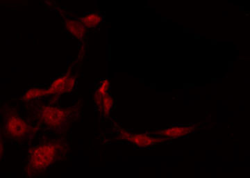 SSTR1 Antibody - Staining HepG2 cells by IF/ICC. The samples were fixed with PFA and permeabilized in 0.1% Triton X-100, then blocked in 10% serum for 45 min at 25°C. The primary antibody was diluted at 1:200 and incubated with the sample for 1 hour at 37°C. An Alexa Fluor 594 conjugated goat anti-rabbit IgG (H+L) Ab, diluted at 1/600, was used as the secondary antibody.