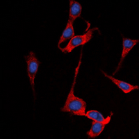 SSTR1 Antibody - Immunofluorescent analysis of SSTR1 staining in A549 cells. Formalin-fixed cells were permeabilized with 0.1% Triton X-100 in TBS for 5-10 minutes and blocked with 3% BSA-PBS for 30 minutes at room temperature. Cells were probed with the primary antibody in 3% BSA-PBS and incubated overnight at 4 deg C in a humidified chamber. Cells were washed with PBST and incubated with a DyLight 594-conjugated secondary antibody (red) in PBS at room temperature in the dark. DAPI was used to stain the cell nuclei (blue).