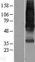 SSTR1 Protein - Western validation with an anti-DDK antibody * L: Control HEK293 lysate R: Over-expression lysate