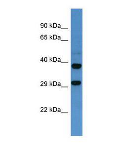 SSTR2 Antibody - Western blot of Human Fetal Brain. SSTR2 antibody dilution 1.0 ug/ml.  This image was taken for the unconjugated form of this product. Other forms have not been tested.