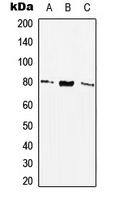 SSTR2 Antibody - Western blot analysis of SSTR2 expression in THP1 (A); NIH3T3 (B); H9C2 (C) whole cell lysates.