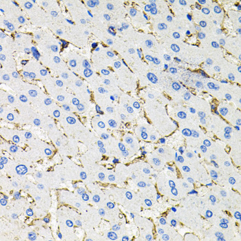 SSTR2 Antibody - Immunohistochemistry of paraffin-embedded human liver injury tissue.