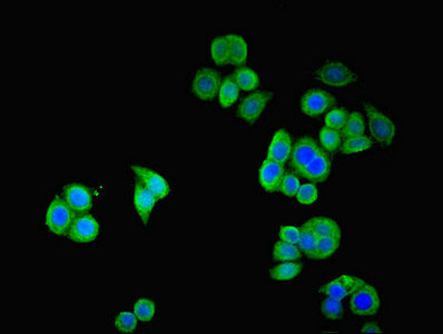 SSTR2 Antibody - Immunofluorescent analysis of PC3 cells cells diluted at 1:100 and Alexa Fluor 488-congugated AffiniPure Goat Anti-Rabbit IgG(H+L)