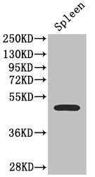SSTR2 Antibody - Western Blot Positive WB detected in:mouse spleen tissue All Lanes: SSTR2 antibody at 2.7ug/ml Secondary Goat polyclonal to rabbit IgG at 1/50000 dilution Predicted band size: 42,41 kDa Observed band size: 41 kDa
