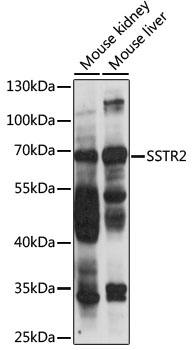 SSTR2 Antibody - Western blot analysis of extracts of various cell lines, using SSTR2 antibody at 1:1000 dilution. The secondary antibody used was an HRP Goat Anti-Rabbit IgG (H+L) at 1:10000 dilution. Lysates were loaded 25ug per lane and 3% nonfat dry milk in TBST was used for blocking. An ECL Kit was used for detection and the exposure time was 30s.