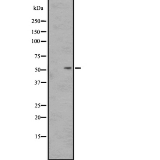 SSTR2 Antibody - Western blot analysis of SS2R expression in HEK293 cells. The lane on the left is treated with the antigen-specific peptide.