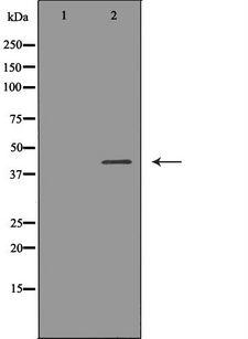 SSTR2 Antibody - Western blot analysis of extracts of mouse thymus tissue lysate using SSTR2 antibody. The lane on the left is treated with the antigen-specific peptide.