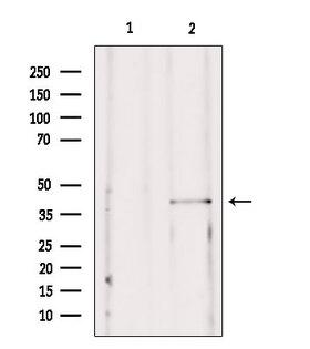 SSTR2 Antibody - Western blot analysis of extracts of mouse brain tissue using SSTR2 antibody. Lane 1 was treated with the blocking peptide.