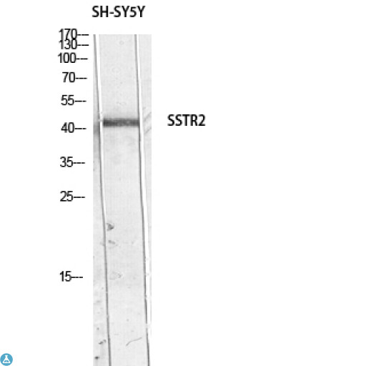 SSTR2 Antibody - Western Blot (WB) analysis of SH-SY5Y lysis using SSTR2 antibody.