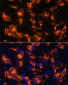 SSTR2 Antibody - Immunofluorescence analysis of C6 cells using SSTR2 Polyclonal Antibody at dilution of 1:100 (40x lens).Blue: DAPI for nuclear staining.