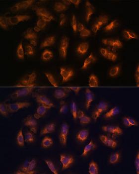 SSTR2 Antibody - Immunofluorescence analysis of U-2OS cells using SSTR2 Polyclonal Antibody at dilution of 1:100 (40x lens).Blue: DAPI for nuclear staining.