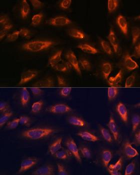 SSTR2 Antibody - Immunofluorescence analysis of U-2OS cells using SSTR2 Polyclonal Antibody at dilution of 1:100 (40x lens).Blue: DAPI for nuclear staining.