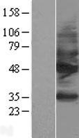 SSTR2 Protein - Western validation with an anti-DDK antibody * L: Control HEK293 lysate R: Over-expression lysate