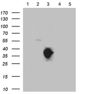 SSTR3 Antibody - Equivalent amounts of lysates. (5 ug per lane) of SSTR1, 2, 3, 4 and 5 peptide. (from lane 1 to 5) were separated by SDS-PAGE and immunoblotted with anti-SSTR3 antibody. (1:500)