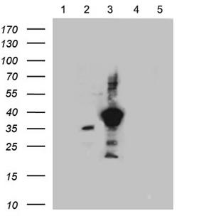 SSTR3 Antibody - Equivalent amounts of lysates. (5 ug per lane) of SSTR1, 2, 3, 4 and 5 peptide. (from lane 1 to 5) were separated by SDS-PAGE and immunoblotted with anti-SSTR3 antibody. (1:500)