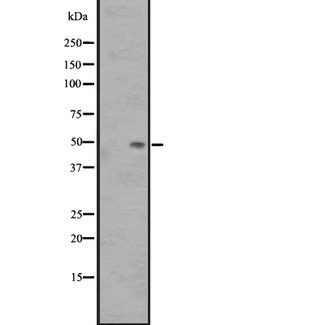 SSTR3 Antibody - Western blot analysis of SS3R expression in Fetal Kidney Lysate. The lane on the left is treated with the antigen-specific peptide.
