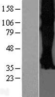 SSTR3 Protein - Western validation with an anti-DDK antibody * L: Control HEK293 lysate R: Over-expression lysate
