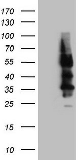 SSTR4 Antibody - HEK293T cells were transfected with the pCMV6-ENTRY control. (Left lane) or pCMV6-ENTRY SSTR4. (Right lane) cDNA for 48 hrs and lysed. Equivalent amounts of cell lysates. (5 ug per lane) were separated by SDS-PAGE and immunoblotted with anti-SSTR4. (1:2000)