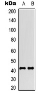 SSTR4 Antibody - Western blot analysis of SSTR4 expression in HEK293T (A); NIH3T3 (B) whole cell lysates.