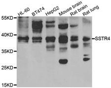 SSTR4 Antibody - Western blot analysis of extracts of various cell lines.