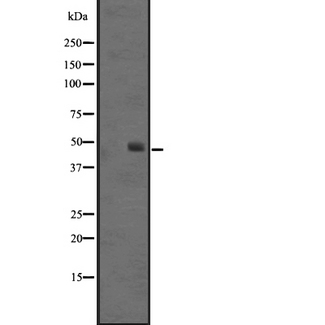 SSTR4 Antibody - Western blot analysis of SS4R expression in Jurkat cells lysate. The lane on the left is treated with the antigen-specific peptide.