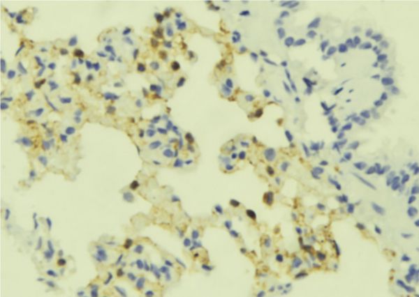SSTR4 Antibody - 1:100 staining mouse lung tissue by IHC-P. The sample was formaldehyde fixed and a heat mediated antigen retrieval step in citrate buffer was performed. The sample was then blocked and incubated with the antibody for 1.5 hours at 22°C. An HRP conjugated goat anti-rabbit antibody was used as the secondary.