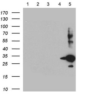 SSTR5 Antibody - Equivalent amounts of lysates. (5 ug per lane) of SSTR1, 2, 3, 4 and 5 peptide. (from lane 1 to 5) were separated by SDS-PAGE and immunoblotted with anti-SSTR5 antibody. (1:500)