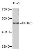 SSTR5 Antibody - Western blot analysis of extracts of HT-29 cells.