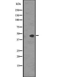 SSTR5 Antibody - Western blot analysis of SS5R expression in HEK293 cells. The lane on the left is treated with the antigen-specific peptide.