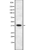 SSTR5 Antibody - Western blot analysis SSTR5 using LOVO cells whole cells lysates