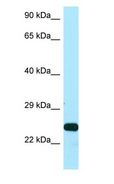 SSU72 Antibody - SSU72 antibody Western Blot of Placenta.  This image was taken for the unconjugated form of this product. Other forms have not been tested.