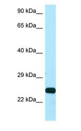 SSU72 Antibody - SSU72 antibody Western Blot of Placenta.  This image was taken for the unconjugated form of this product. Other forms have not been tested.