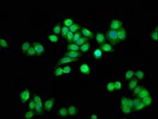 SSU72 Antibody - Immunofluorescence staining of PC-3 cells with SSU72 Antibody at 1:33, counter-stained with DAPI. The cells were fixed in 4% formaldehyde, permeabilized using 0.2% Triton X-100 and blocked in 10% normal Goat Serum. The cells were then incubated with the antibody overnight at 4°C. The secondary antibody was Alexa Fluor 488-congugated AffiniPure Goat Anti-Rabbit IgG(H+L).