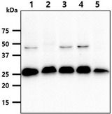 SSU72 Antibody - The cell lysates (40ug) were resolved by SDS-PAGE, transferred to PVDF membrane and probed with anti-human SSU72 antibody (1:1000). Proteins were visualized using a goat anti-mouse secondary antibody conjugated to HRP and an ECL detection system. Lane 1.: Jurkat cell lysate Lane 2.: K562 cell lysate Lane 3.: HeLa cell lysate Lane 4.: MCF7 cell lysate Lane 5.: LnCap cell lysate