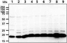 SSU72 Antibody - The cell lysates (40ug) were resolved by SDS-PAGE, transferred to PVDF membrane and probed with anti-human SSU72 antibody (1:1000). Proteins were visualized using a goat anti-mouse secondary antibody conjugated to HRP and an ECL detection system. Lane 1.: Jurkat cell lysate Lane 2.: K562 cell lysate Lane 3.: 293T cell lysate Lane 4.: HepG2 cell lysate Lane 5.: A549 cell lysate Lane 6.: MCF-7 cell lysate Lane 7.: SK-OV-3 cell lysate Lane 8.: LnCap cell lysate Lane 9.: HeLa cell lysate