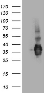 SSU72 Antibody - HEK293T cells were transfected with the pCMV6-ENTRY control. (Left lane) or pCMV6-ENTRY SSU72. (Right lane) cDNA for 48 hrs and lysed. Equivalent amounts of cell lysates. (5 ug per lane) were separated by SDS-PAGE and immunoblotted with anti-SSU72. (1:2000)