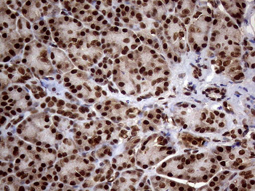 SSU72 Antibody - Immunohistochemical staining of paraffin-embedded Human pancreas tissue within the normal limits using anti-SSU72 mouse monoclonal antibody. (Heat-induced epitope retrieval by 1mM EDTA in 10mM Tris buffer. (pH8.5) at 120°C for 3 min. (1:1000)