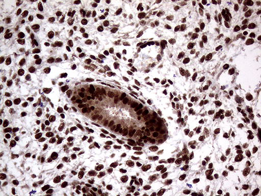 SSU72 Antibody - Immunohistochemical staining of paraffin-embedded Human endometrium tissue within the normal limits using anti-SSU72 mouse monoclonal antibody. (Heat-induced epitope retrieval by 1mM EDTA in 10mM Tris buffer. (pH8.5) at 120°C for 3 min. (1:1000)