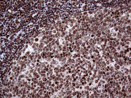 SSU72 Antibody - Immunohistochemical staining of paraffin-embedded Human lymph node tissue within the normal limits using anti-SSU72 mouse monoclonal antibody. (Heat-induced epitope retrieval by 1mM EDTA in 10mM Tris buffer. (pH8.5) at 120°C for 3 min. (1:1000)