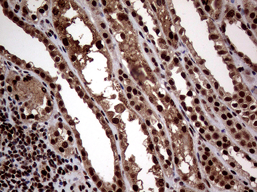 SSU72 Antibody - Immunohistochemical staining of paraffin-embedded Human Kidney tissue within the normal limits using anti-SSU72 mouse monoclonal antibody. (Heat-induced epitope retrieval by 1mM EDTA in 10mM Tris buffer. (pH8.5) at 120°C for 3 min. (1:1000)