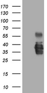 SSU72 Antibody - HEK293T cells were transfected with the pCMV6-ENTRY control. (Left lane) or pCMV6-ENTRY SSU72. (Right lane) cDNA for 48 hrs and lysed